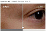 SkinMedica TNS